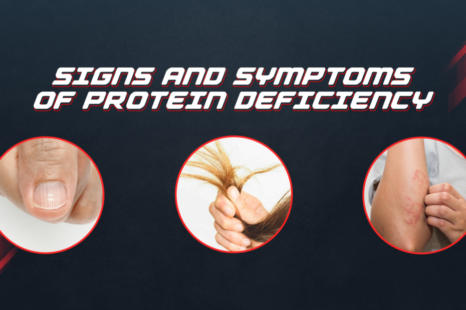 Signs And Symptoms Of Protein Deficiency