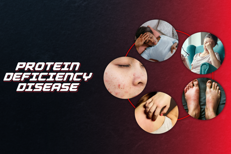 Protein Deficiency Diseases List